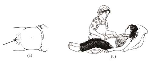 Diagram (a) shows the top of the pubic bone (b) A HEP measuring a pregnant woman's uterus