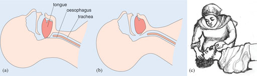 Diagram of a person's airway