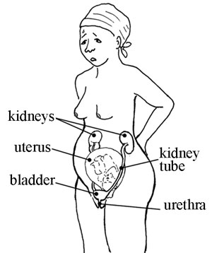 A diagram showing the main features of the urinary tract in a woman