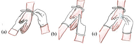 The three steps to inserting an IV cannula.