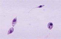 Leishmania protozoa
