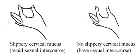 Diagrammatic illustration of slippery and non-elastic cervical mucus.
