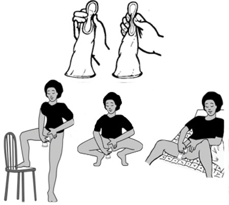 how to use female condom