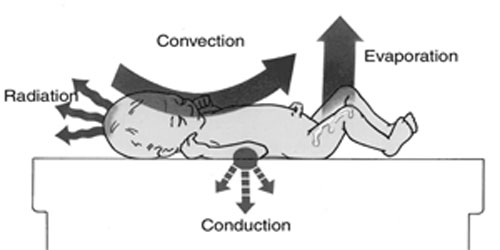 A baby lies on a platform with arrows showing the mechanisms of heat loss from a baby's skin.